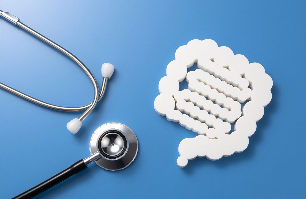 炎症性腸疾患（IBD）